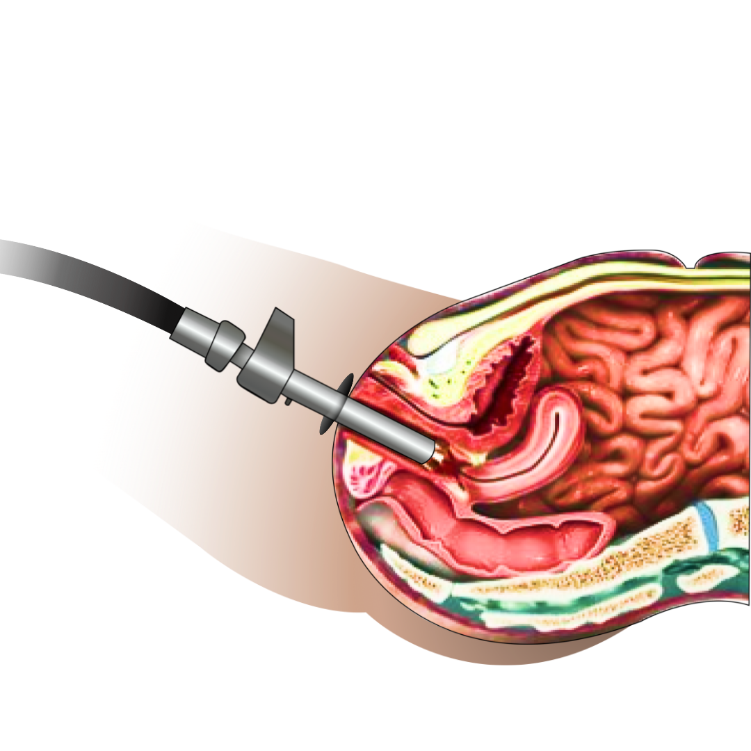 monalisatreatment(3).png