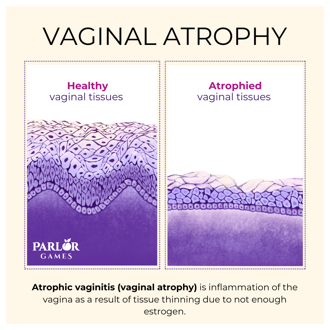 Atrophicvaginitis.png