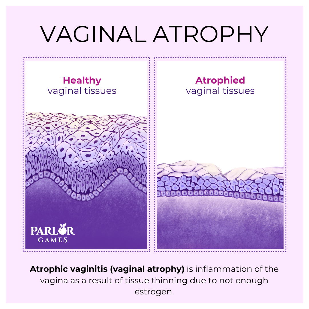 atrophy_comparison.png
